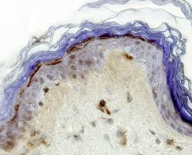 SLURP1 antibody in Human Skin by Immunohistochemistry (IHC-P).