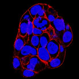 SNAP23 antibody in HepG2 Human Cell Line by Immunocytochemistry (ICC).