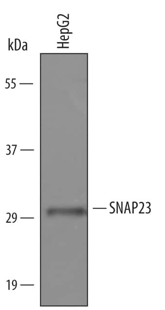 Detection of Human SNAP23 antibody by Western Blot.