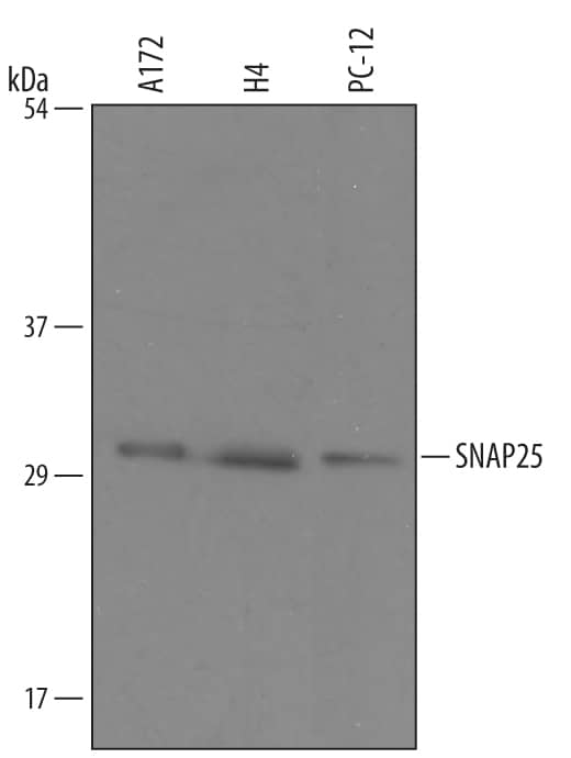 Detection of Human and Rat SNAP25 antibody by Western Blot.