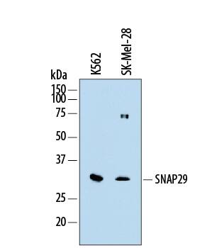 Detection of Human SNAP29 antibody by Western Blot.