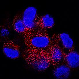 SNAP29 antibody in HepG2 Human Cell Line by Immunocytochemistry (ICC).