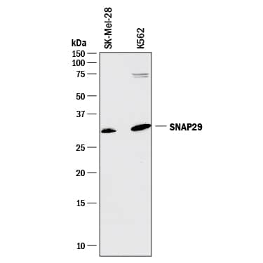 Detection of Human SNAP29 antibody by Western Blot.