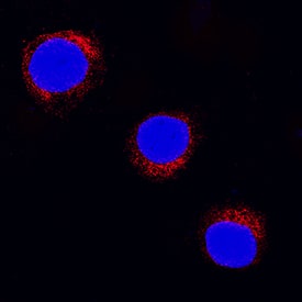 SOCS-5 antibody in Jurkat Human Cell Line by Immunocytochemistry (ICC).