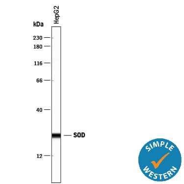 Detection of Human SOD1/Cu-Zn SOD antibody by Simple WesternTM.