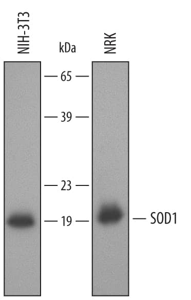 Detection of Mouse/Rat SOD1/Cu-Zn SOD antibody by Western Blot.