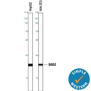 Detection of Human and Mouse SOD2/Mn-SOD antibody by Simple WesternTM.
