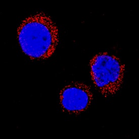 SOD2/Mn-SOD antibody in HL-60 Human Cell Line by Immunocytochemistry (ICC).