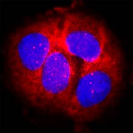 SOD2/Mn-SOD antibody in MCF-7 Human Cell Line by Immunocytochemistry (ICC).