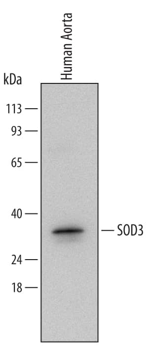 Detection of Human SOD3/EC-SOD antibody by Western Blot.