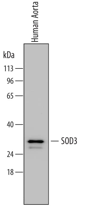 Detection of Human SOD3/EC-SOD antibody by Western Blot.