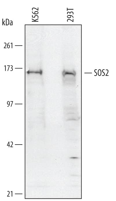 Detection of Human SOS2 antibody by Western Blot.