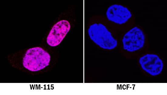 SOX10 antibody in WM-155 Human Cell Line by Immunocytochemistry (ICC).