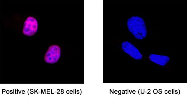 SOX10 antibody in SK-Mel-28 Human Cell Line by Immunocytochemistry (ICC).