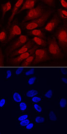 SOX11 antibody in HeLa Human Cell Line by Immunocytochemistry (ICC).
