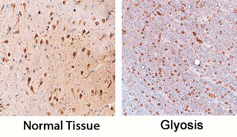 SOX11 antibody in Human Brain by Immunohistochemistry (IHC-P).