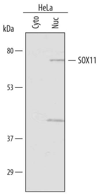 Detection of Human SOX11 antibody by Western Blot.