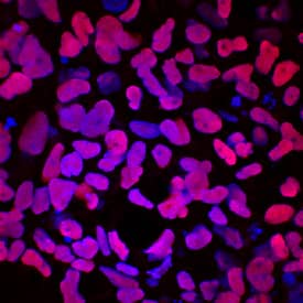 SOX17 antibody in iBJ6 Cell Line by Immunocytochemistry (ICC).