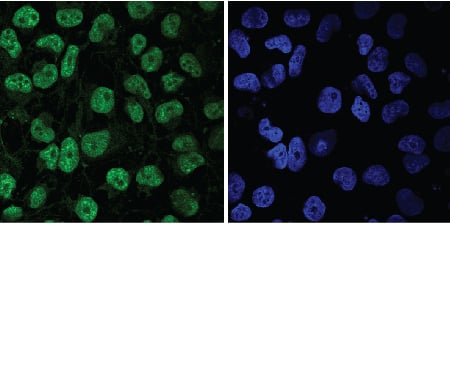 SOX17 antibody in BG01V Human Embryonic Stem Cells by Immunocytochemistry (ICC).