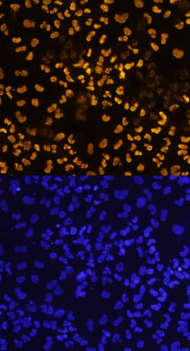 SOX17 antibody in BG01V Human Stem Cells by Immunocytochemistry (ICC).