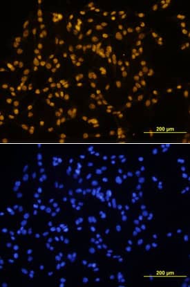 SOX17 antibody in B16 Mouse Cell Line by Immunocytochemistry (ICC).