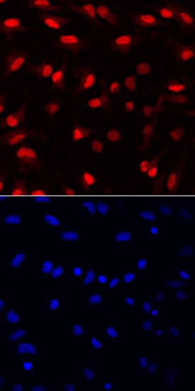 SOX1 antibody in Rat Cortical Stem Cells by Immunocytochemistry (ICC).