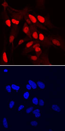 SOX1 antibody in Mouse Cortical Stem Cells by Immunocytochemistry (ICC).