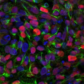 SOX1 antibody in ectoderm differentuiated BG01V Human Embryonic Stem Cells by Immunocytochemistry (ICC).