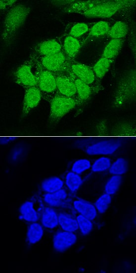 SOX1 antibody in differentiated NTera-2 Human Cell Line by Immunocytochemistry (ICC).