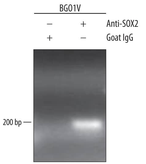 Detection of SOX2-regulated Genes antibody by Chromatin Immunoprecipitation.
