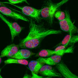 SOX2 antibody in Mouse Cortical Stem Cells by Immunocytochemistry (ICC).