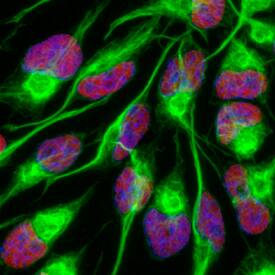 SOX2 antibody in Rat Cortical Stem Cells by Immunocytochemistry (ICC).