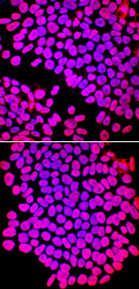 SOX2 antibody in ADLF1 and FAB2 Stem Cell Lines by Immunocytochemistry (ICC).