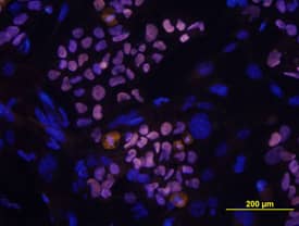 SOX2 antibody in BG01V Human Embryonic Stem Cells by Immunocytochemistry (ICC).
