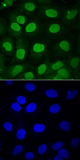 SOX3 antibody in NTera-2 Human Cell Line by Immunocytochemistry (ICC).