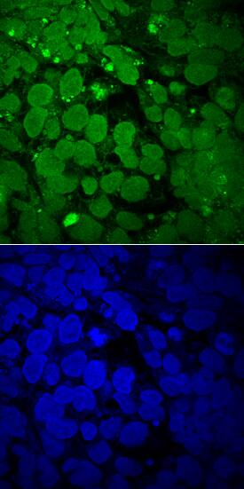 SOX3 antibody in NTera-2 Human Cell Line by Immunocytochemistry (ICC).