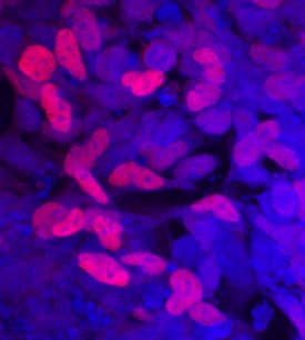 SOX9 antibody in BG01V Human Embryonic Stem Cells by Immunocytochemistry (ICC).