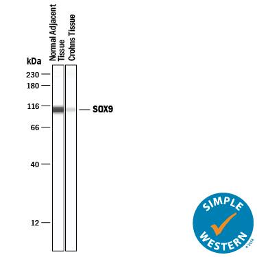 Detection of Human SOX9 antibody by Simple WesternTM.