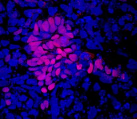 SOX9 antibody in BGO1V Human Embryonic Stem Cells by Immunocytochemistry (ICC).