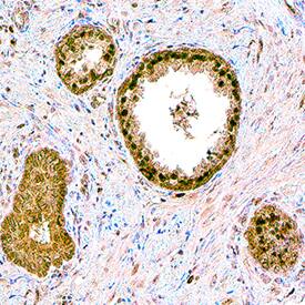 Sphingosine Kinase 1/SPHK1 antibody in Human Prostate by Immunohistochemistry (IHC-P).