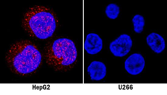 Sphingosine Kinase 1/SPHK1 antibody in HepG2 and U266 Human Cell Lines by Immunocytochemistry (ICC).