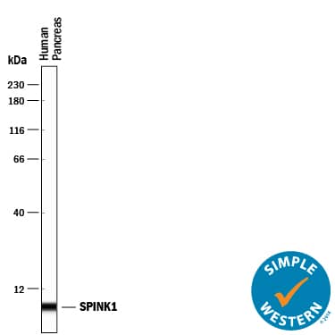Detection of Human SPINK1 antibody by Simple WesternTM.