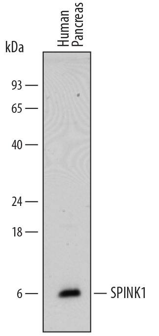 Detection of Human SPINK1 antibody by Western Blot.