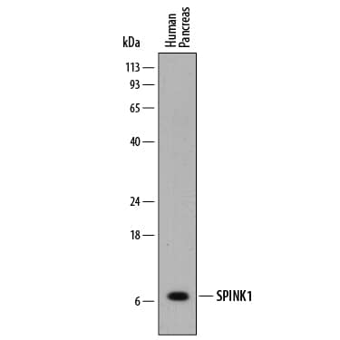 Detection of Human SPINK1 antibody by Western Blot.