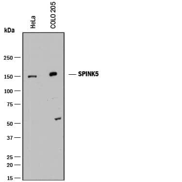 Detection of Human SPINK5 antibody by Western Blot.