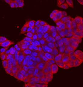 SPRED2 antibody in PC-12 Rat Cell Line by Immunocytochemistry (ICC).