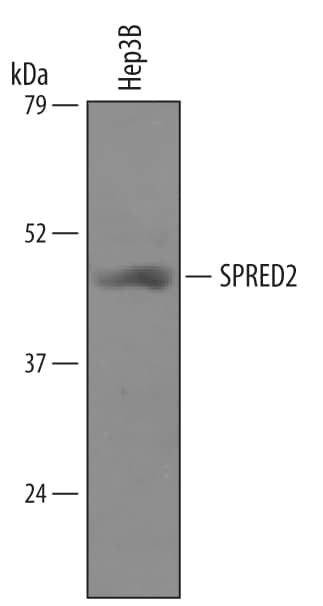 Detection of Human SPRED2 antibody by Western Blot.