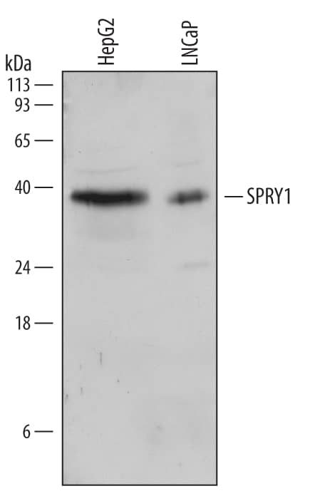 Detection of Human SPRY1 antibody by Western Blot.