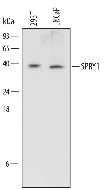 Detection of Human SPRY1 antibody by Western Blot.