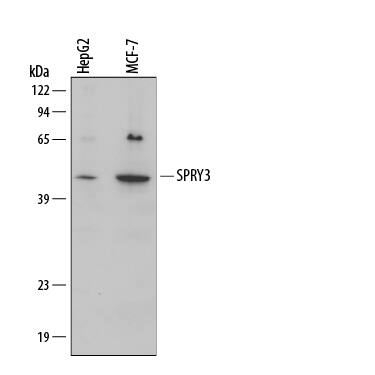 Detection of Human SPRY3 antibody by Western Blot.